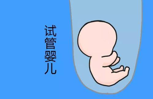 多囊卵巢案例